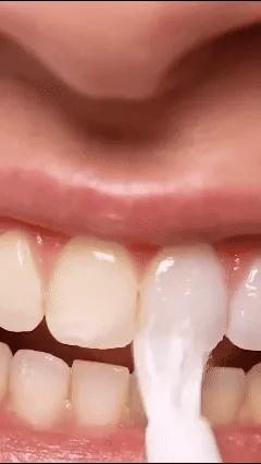 Lapiz blanqueador dental