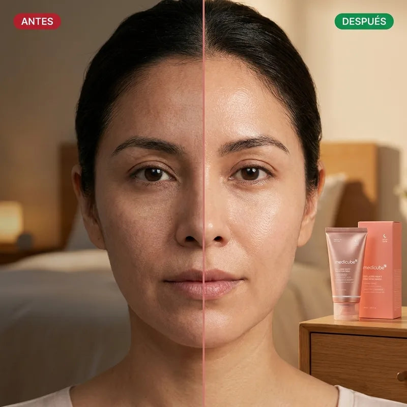 Antes y después